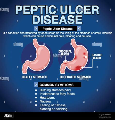 what is a peptic injury